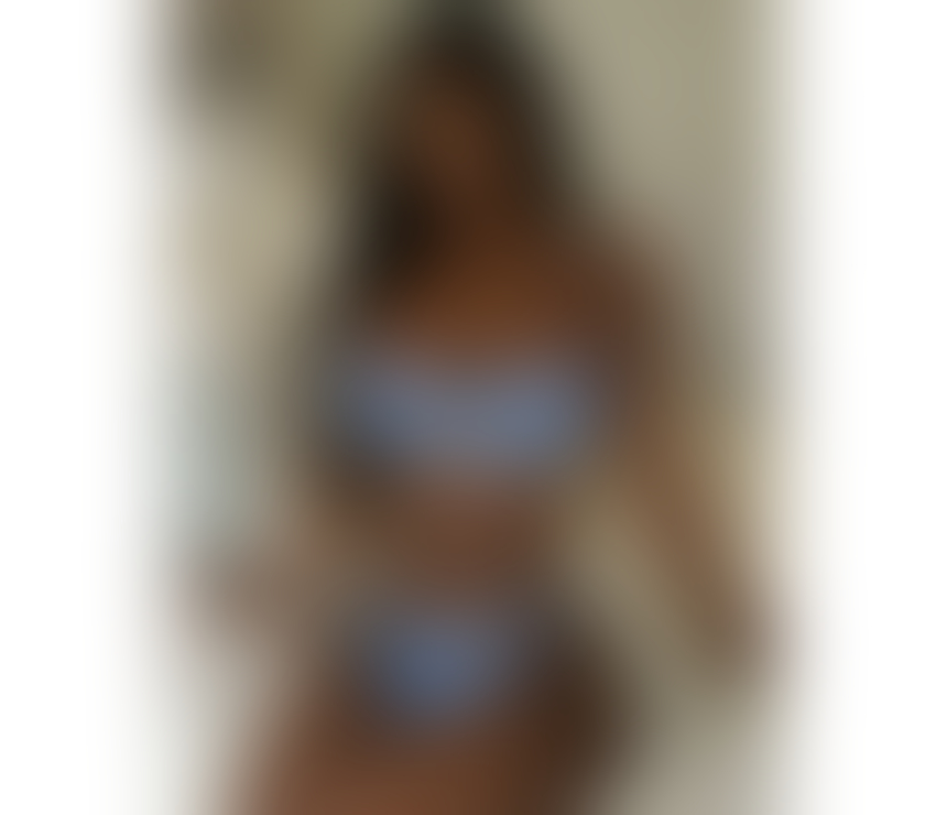 Escorts Halton Runcorn - Halton - Photos for 🥰🫶 NEW town💖SEXY🫦✨️ Bianca✨️ 🍀💖